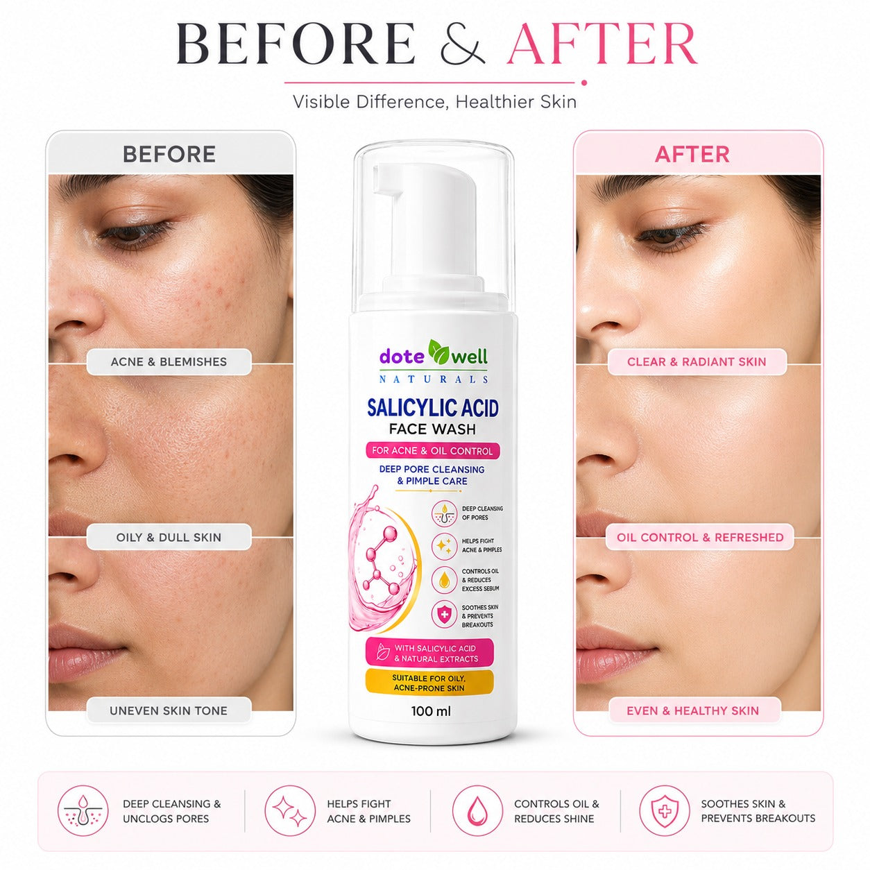 Salicylic Acid Facewash 100 ml