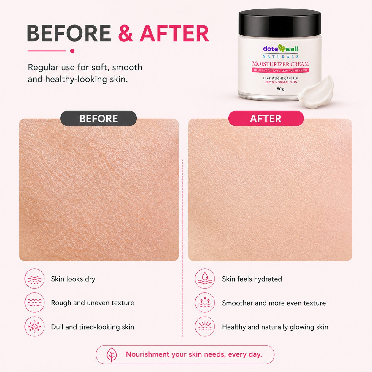 Moisturizer 50 gm